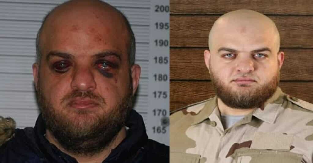 صورة فظيعة لتعذيب فرنسا إسلام علوش الناطق السابق باسم “جيش الإسلام” في سوريا!