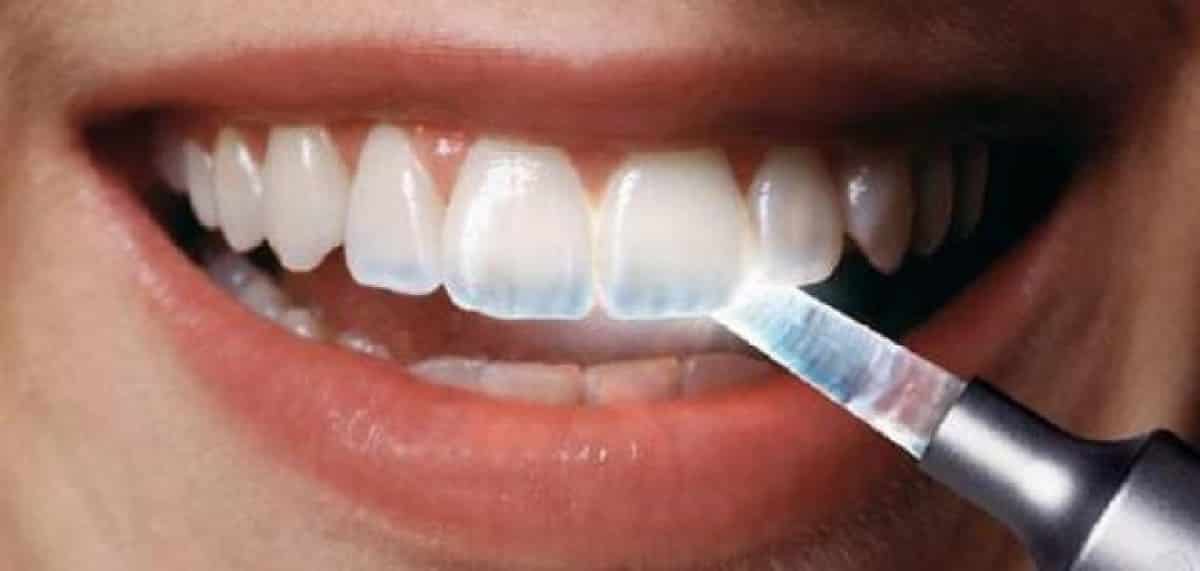 معرفة السبب أساس الحلّ .. احذروا 4 أسباب تصيب أسنانكم بالتكلس