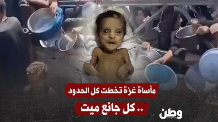 تحذيرات من كارثة إنسانية في غزة: وفاة 69 طفلًا بسبب سوء التغذية