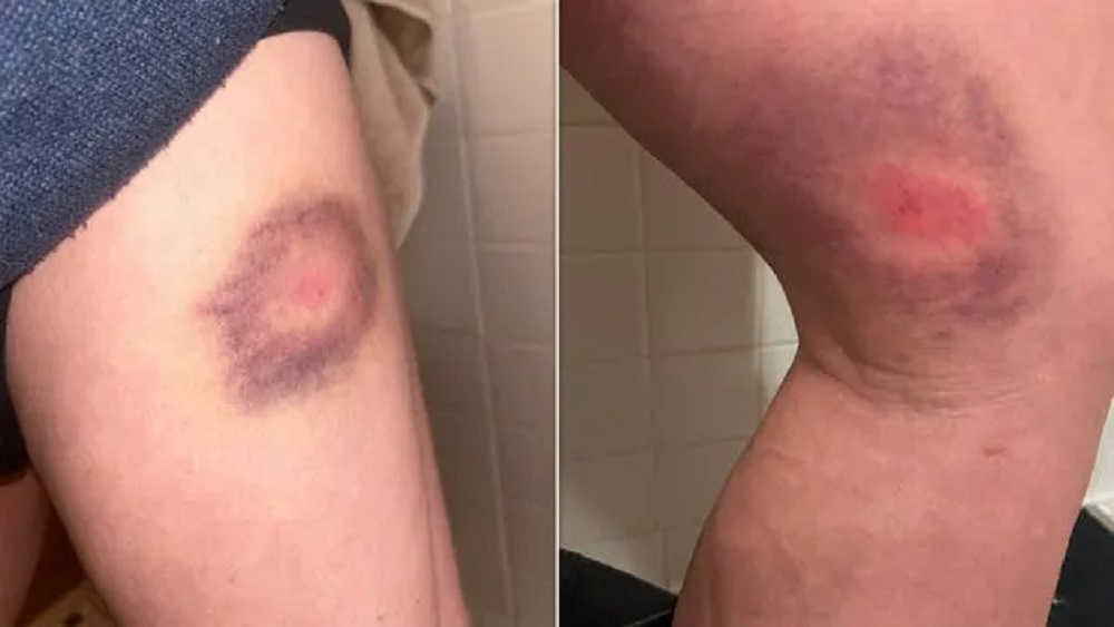 وبينما يؤكد أبرناثي أنه لم يتعرض من قبل للضرب أو التقييد أو الرش بالفلفل طوال مسيرته، فإنه لا ينوي التراجع عن عمله التوثيقي