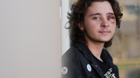 متظاهر يفقد بصره وسط تصاعد المواجهات العنيفة مع العملاء الفيدراليين